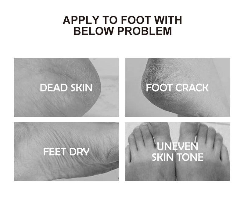 Măști peeling pentru picioare, 35ml (set de 5 perechi)